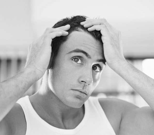 Stock image of a male model feeling unhappy with hair loss