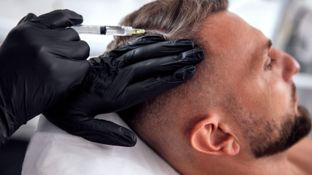 Hair Restoration Houston in Houston, TX