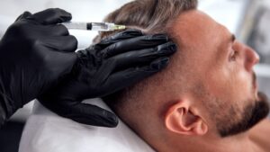 Hair Restoration Houston in Houston, TX