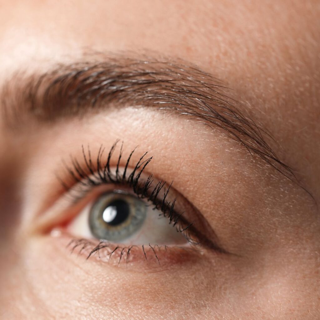 NeoGraft Houston eyebrow transplant