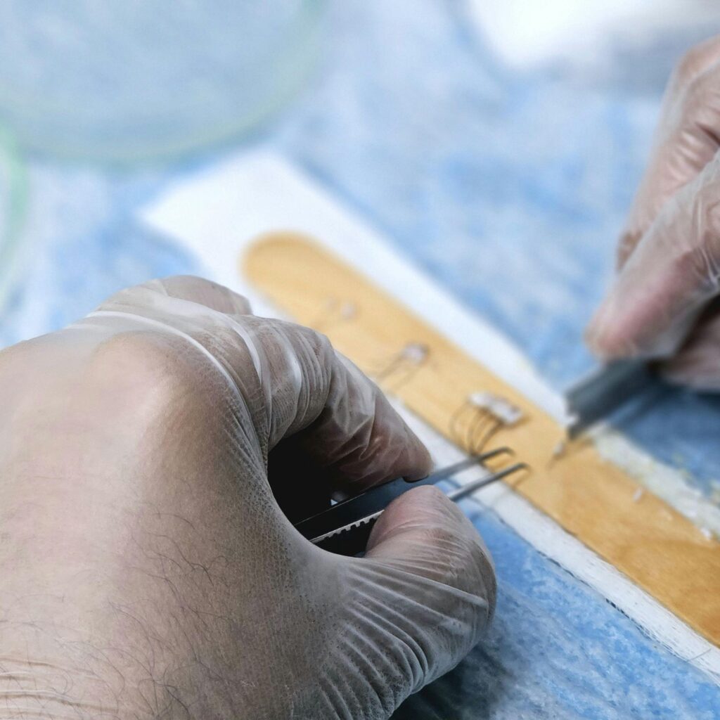 neograft houston hair transplant male